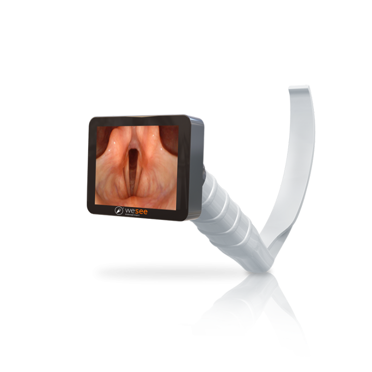 Video Laryngoscope Featured Image